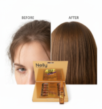 CAJA AMPOLLAS ANTI- HAIR LOSS TRATAMIENTO NELLY 10ML X 10 - Imagen 2
